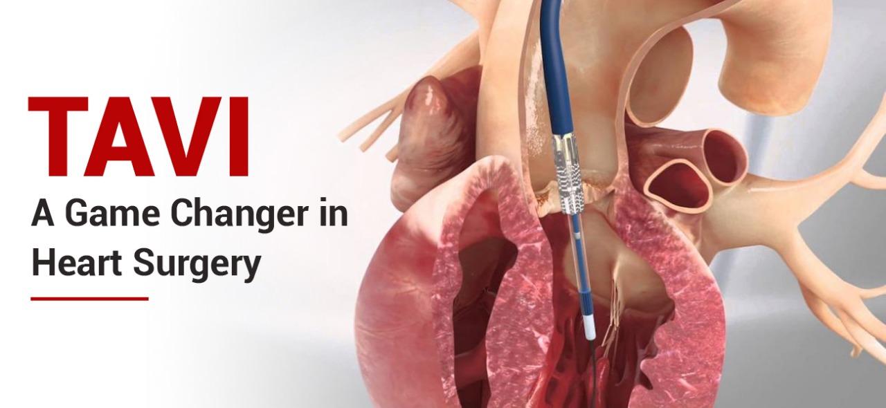 tavi-transcatheter-aortic-valve-implantation-kushal-cardiac-care